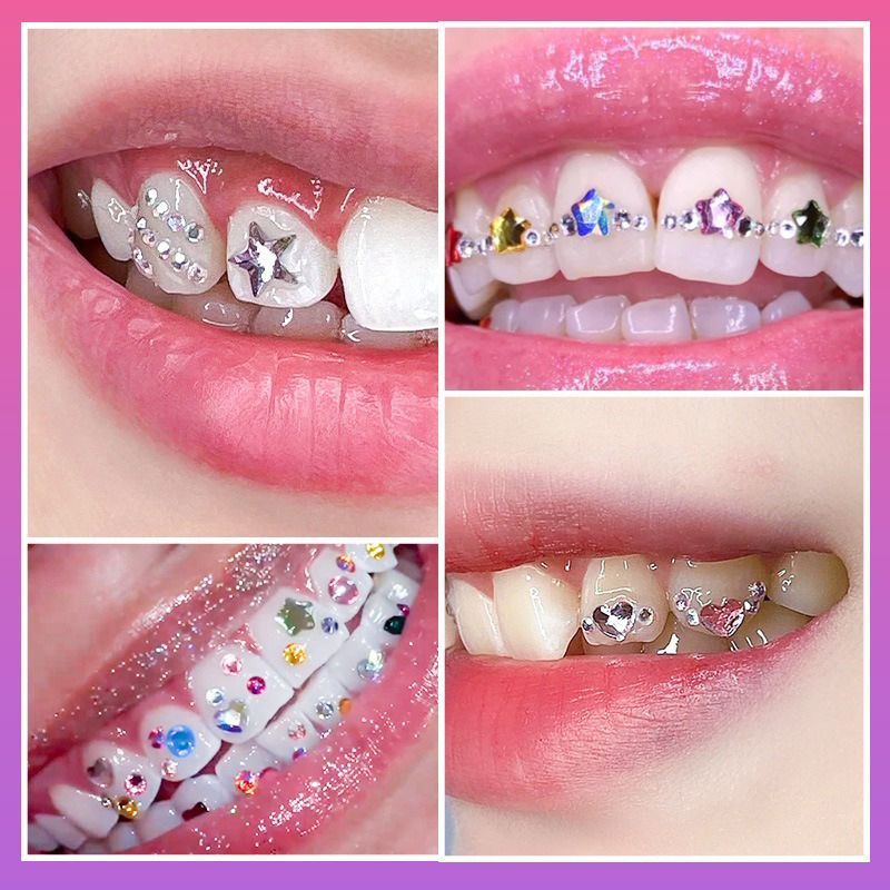 NEW Professional Tooth Gem Kit - Tooth Gem Kit review and price