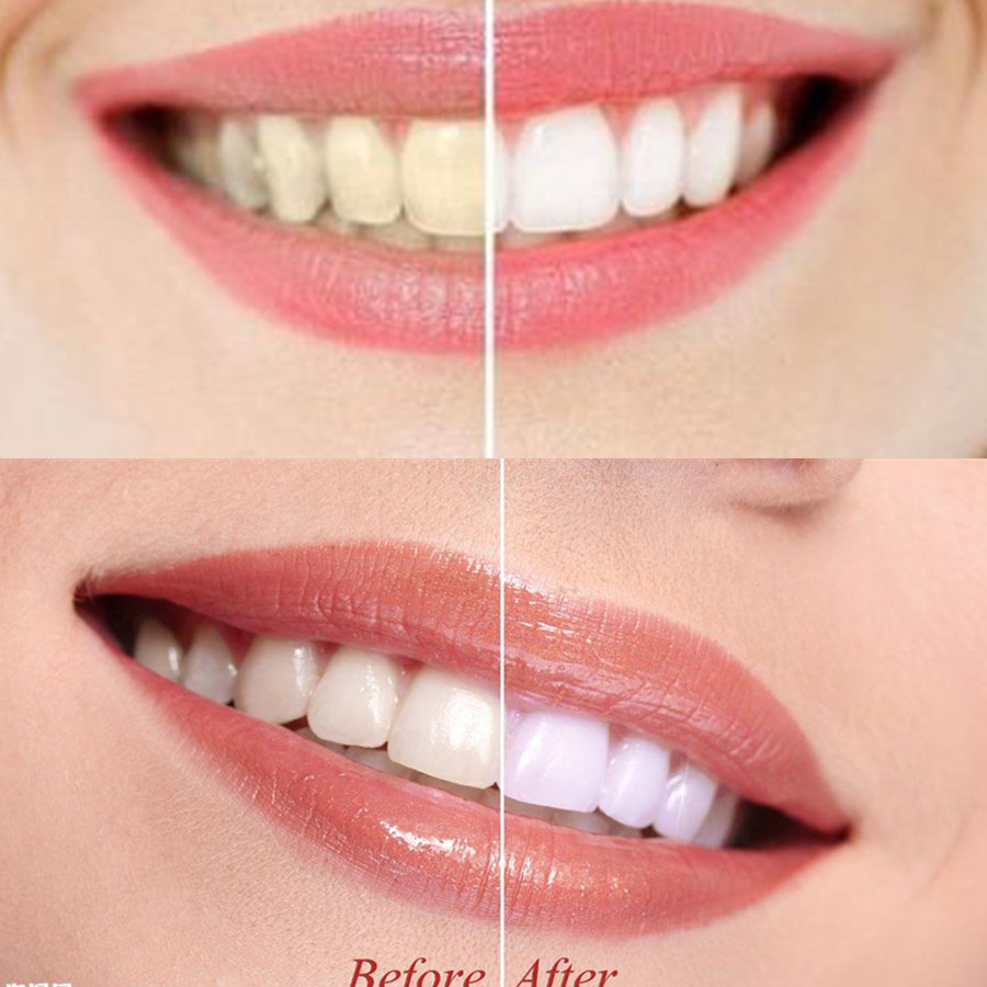 Bamboo Charcoal Teeth Tooth De - Teeth Whitening Charcoal review and price