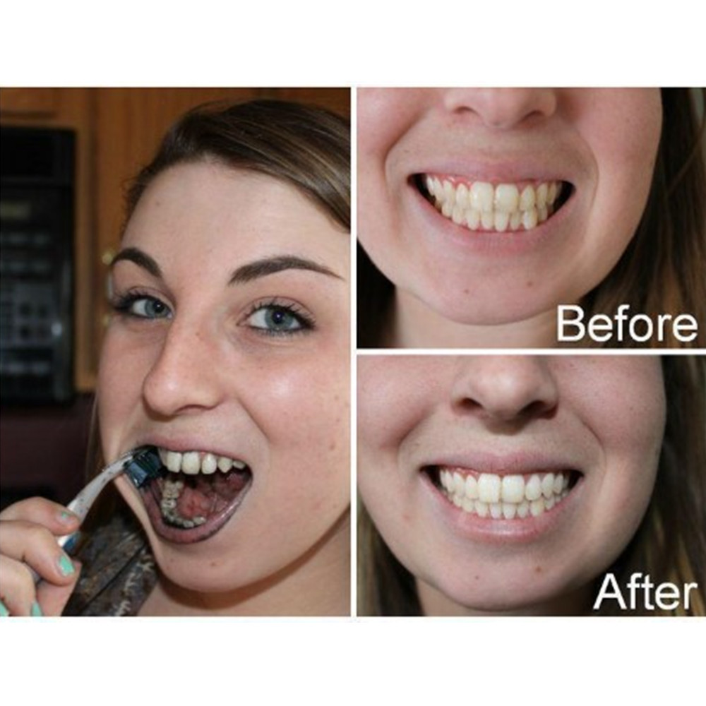 Bamboo Charcoal Teeth Tooth De - Teeth Whitening Charcoal review and price
