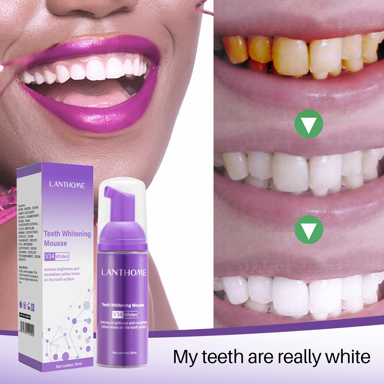 V34 Mousse Teeth Cleaning Toot - Teeth Whitening Yellow Teeth review and price
