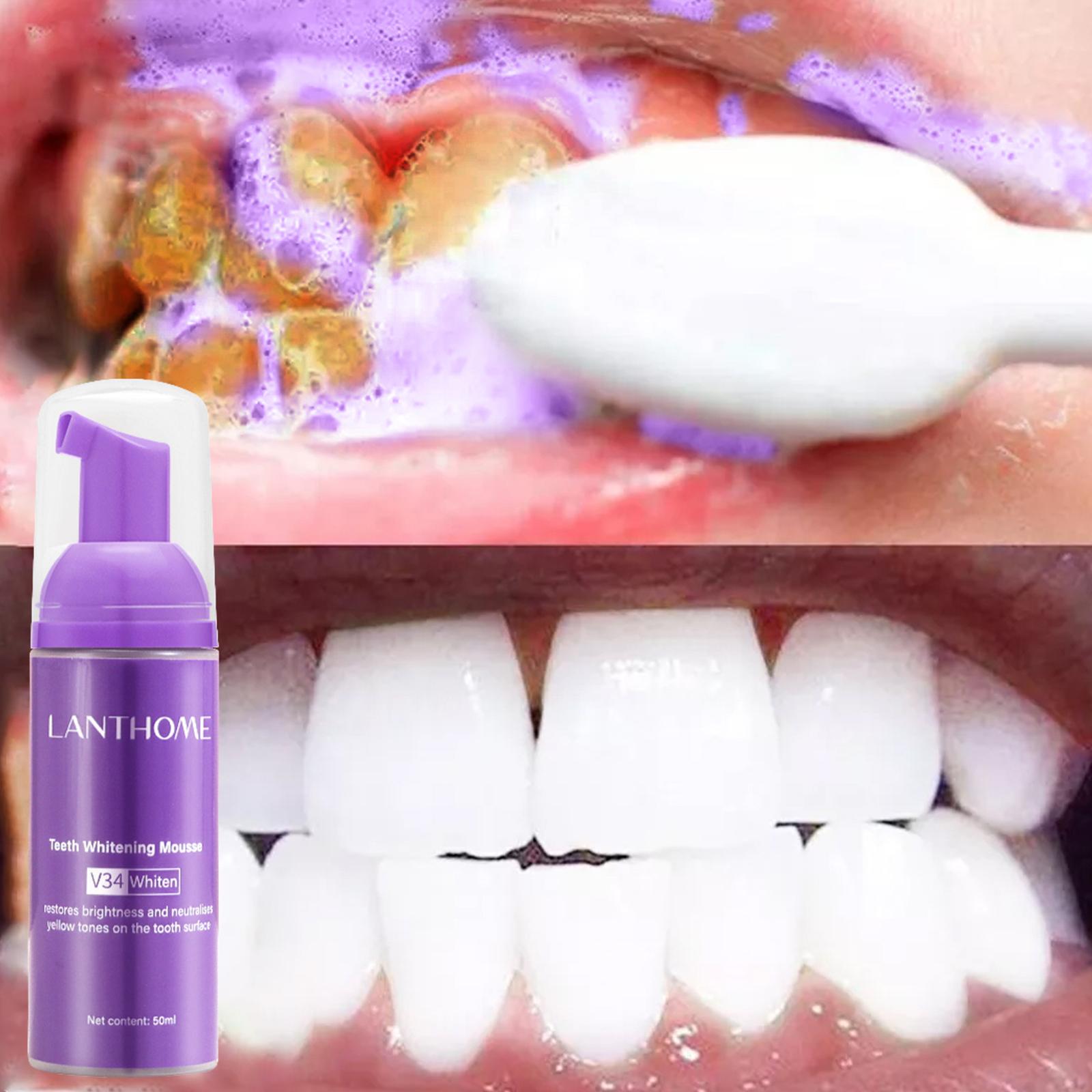 V34 Mousse Teeth Cleaning Toot - Teeth Whitening Yellow Teeth review and price