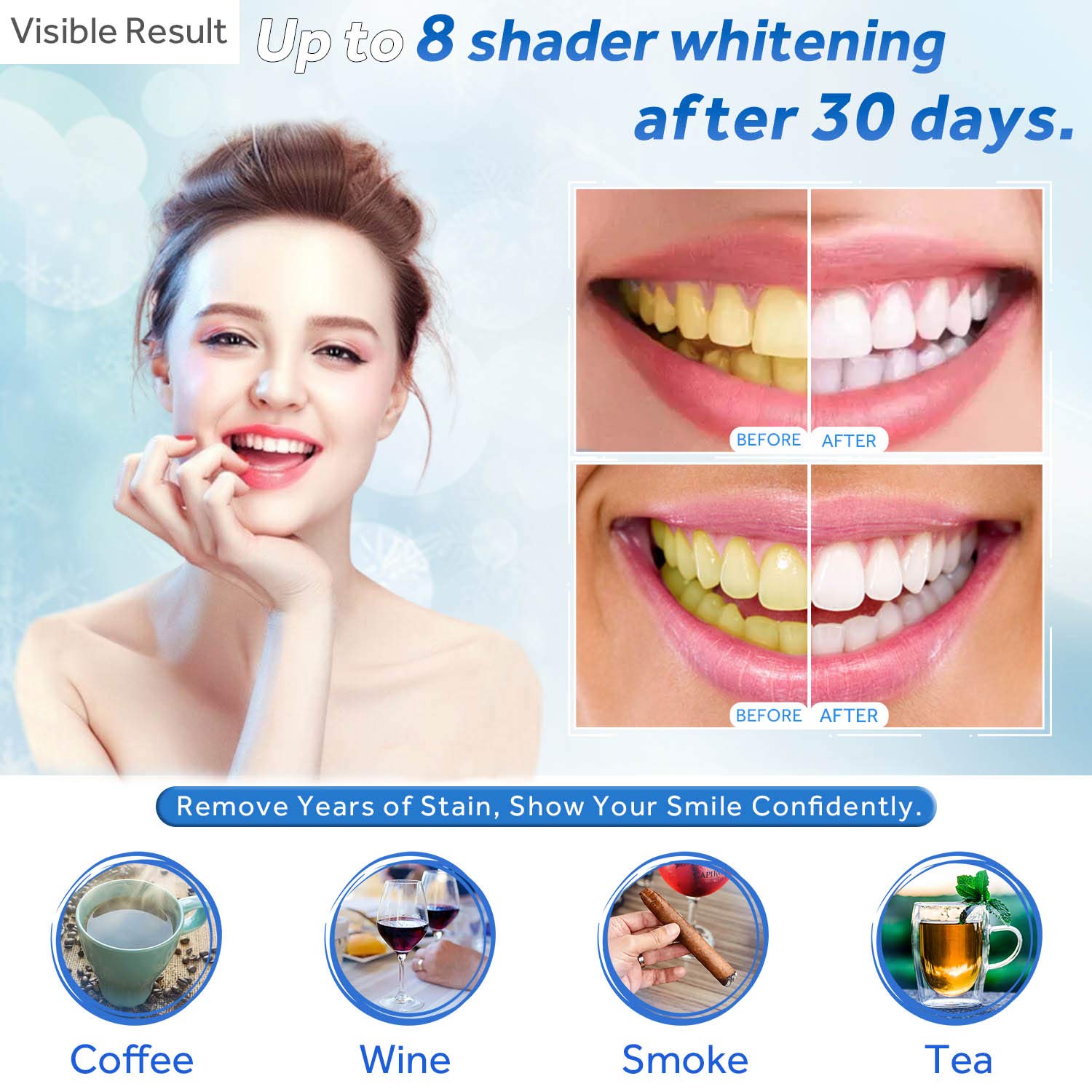 Teeth Whitening Gel Refill Syr - Teeth Whitening With Hydrogen Peroxide review and price