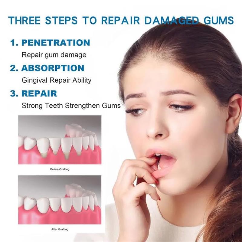 Gum Repair Care Serum Relieve  - Teeth Whitening Gingival Barrier review and price
