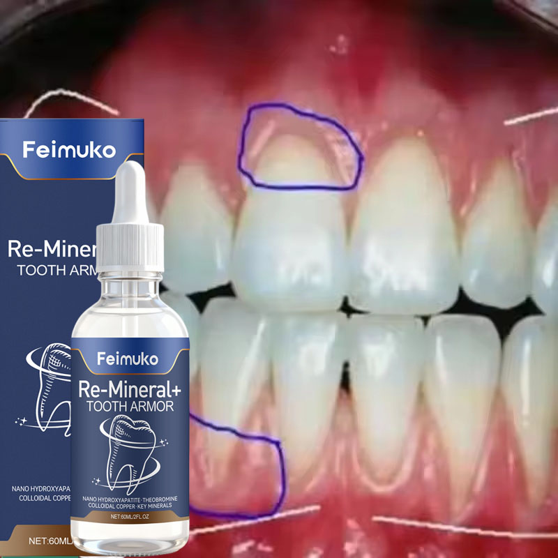 Gum Repair Care Serum Relieve  - Teeth Whitening Gingival Barrier review and price