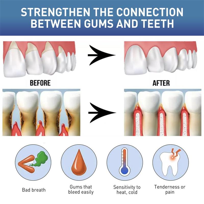 Gum Repair Care Serum Relieve  - Teeth Whitening Gingival Barrier review and price
