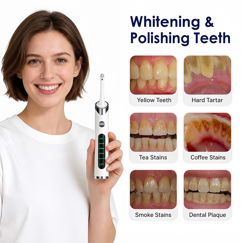 Tooth Polisher Teeth Whitening - Teeth Whitening Light Kit review and price