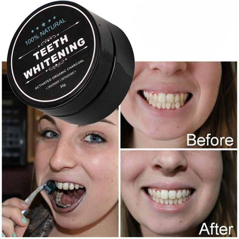 1 Box Activated Charcoal Teeth - Whitening Powder Activated review and price