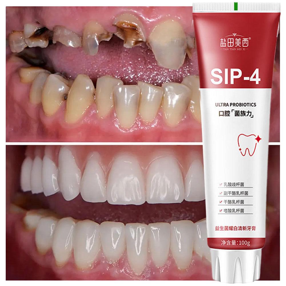 100g Sip-4 Probiotic Whitening - Teeth Whitening Yellow Teeth review and price