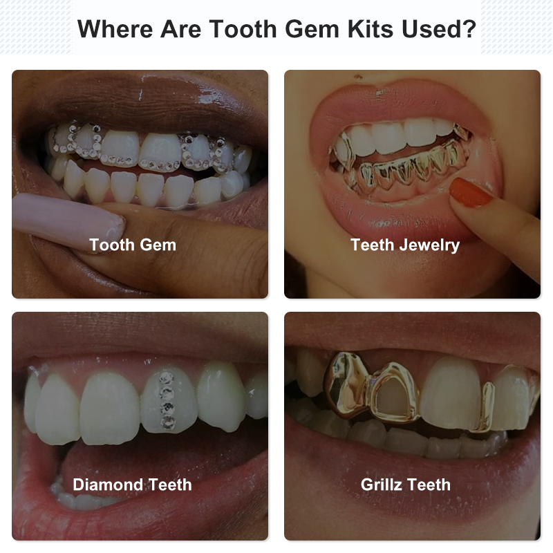 Tooth Gem Set Glue Kit with UV - Tooth Gem Kit review and price